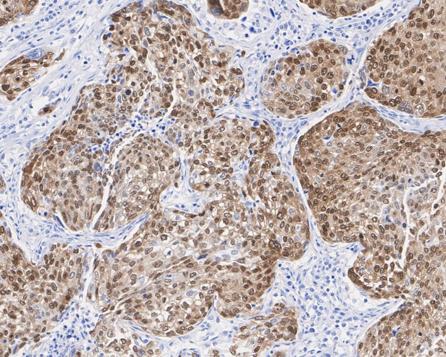 SOX2 Antibody in Immunohistochemistry (Paraffin) (IHC (P))