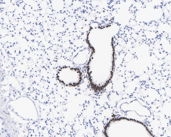 SOX2 Antibody in Immunohistochemistry (Paraffin) (IHC (P))