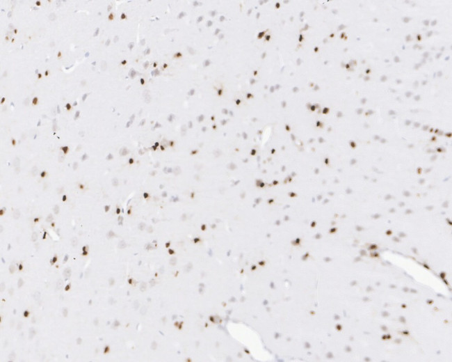 SOX2 Antibody in Immunohistochemistry (Paraffin) (IHC (P))