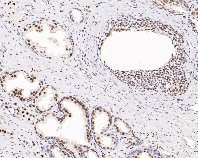 Androgen Receptor Antibody in Immunohistochemistry (Paraffin) (IHC (P))