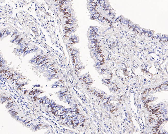 Androgen Receptor Antibody in Immunohistochemistry (Paraffin) (IHC (P))