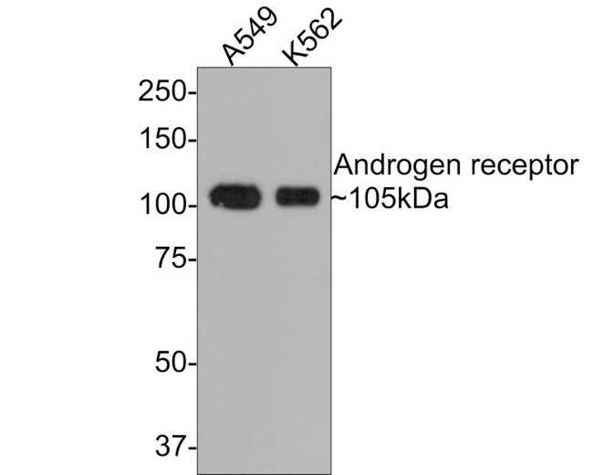 Androgen Receptor Antibody in Western Blot (WB)