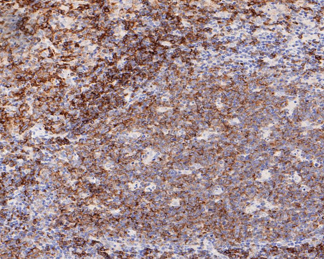 CD22 Antibody in Immunohistochemistry (Paraffin) (IHC (P))