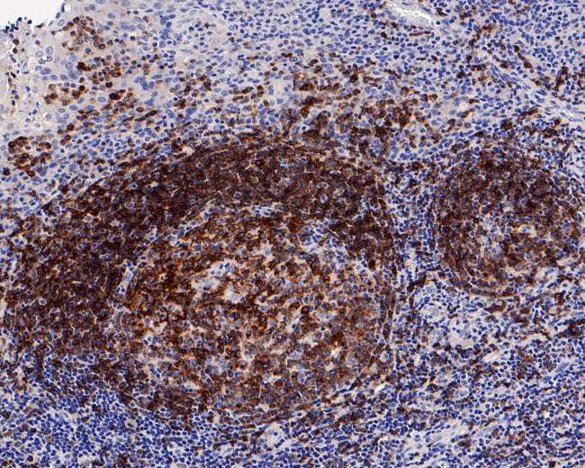 CD22 Antibody in Immunohistochemistry (Paraffin) (IHC (P))