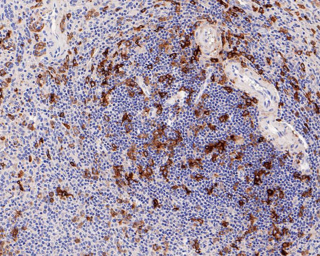 CD13 Antibody in Immunohistochemistry (Paraffin) (IHC (P))