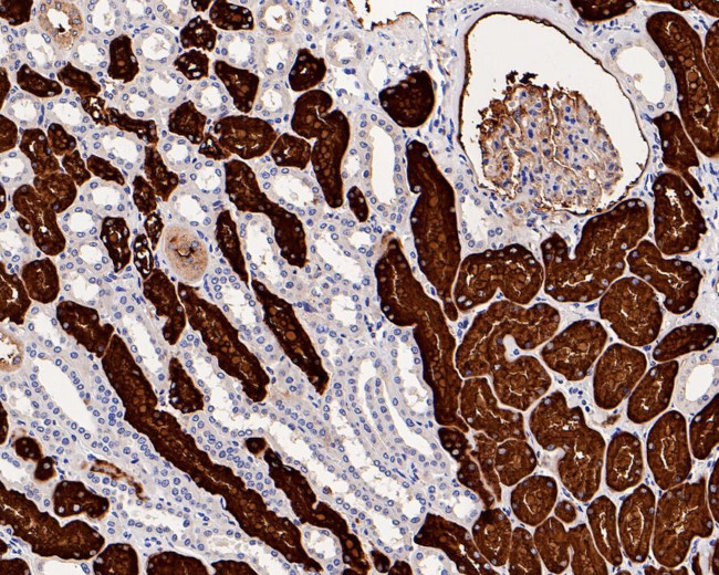 CD13 Antibody in Immunohistochemistry (Paraffin) (IHC (P))