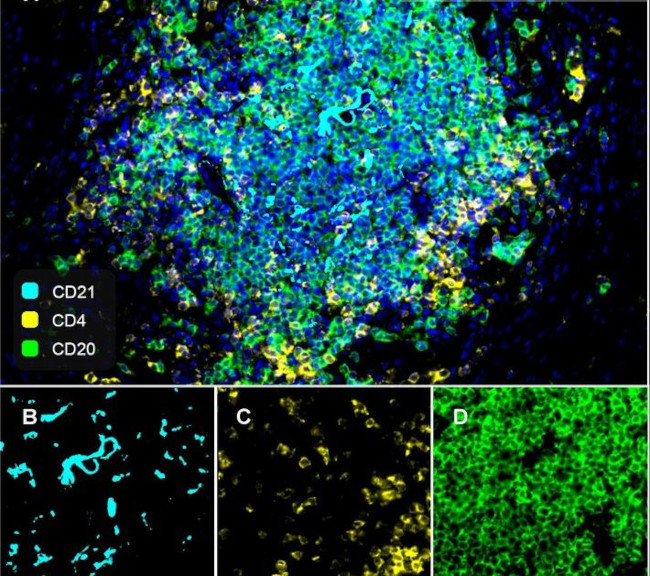 CD21 Antibody in Immunohistochemistry (PFA fixed) (IHC (PFA))