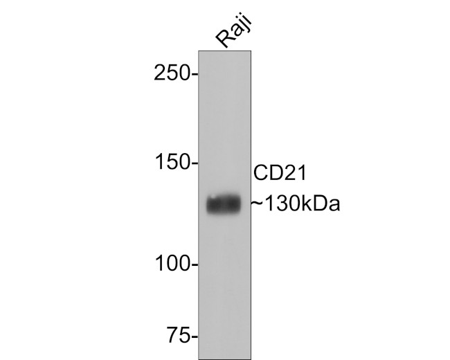 CD21 Antibody in Western Blot (WB)