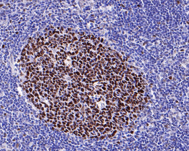 MSH6 Antibody in Immunohistochemistry (Paraffin) (IHC (P))