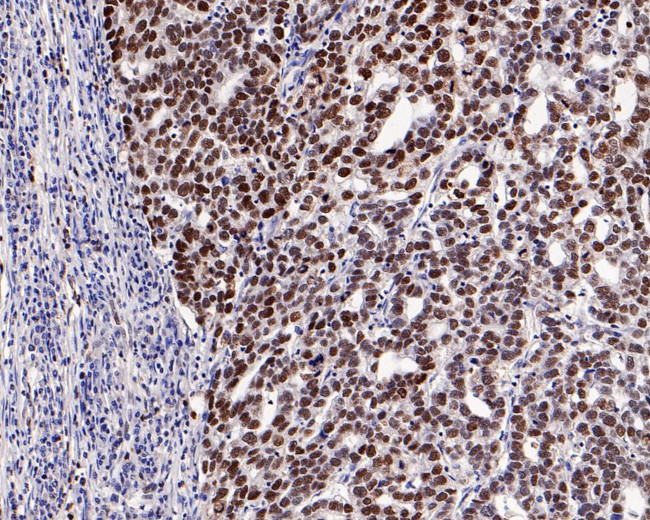 MSH6 Antibody in Immunohistochemistry (Paraffin) (IHC (P))