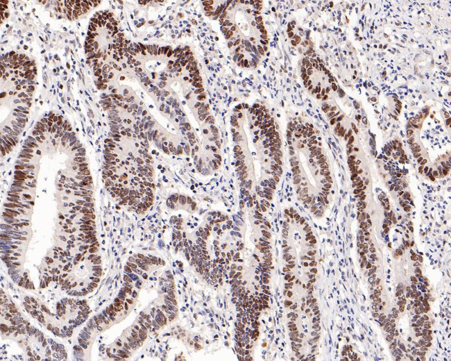 MSH6 Antibody in Immunohistochemistry (Paraffin) (IHC (P))