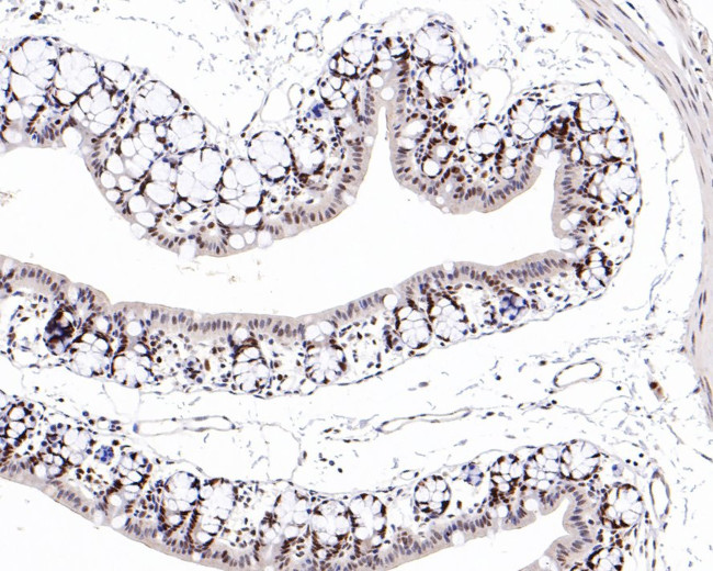 MSH6 Antibody in Immunohistochemistry (Paraffin) (IHC (P))