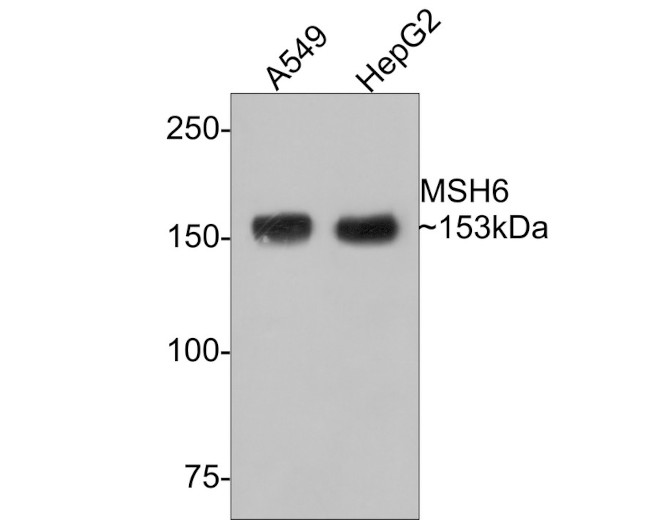 MSH6 Antibody in Western Blot (WB)