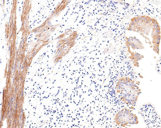 DOG-1 Antibody in Immunohistochemistry (Paraffin) (IHC (P))