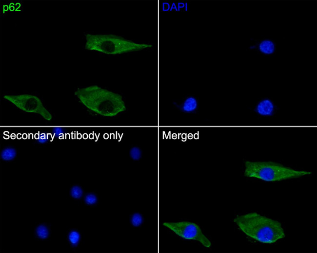 SQSTM1 Antibody in Immunocytochemistry (ICC/IF)