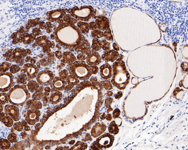 Thyroid Peroxidase Antibody in Immunohistochemistry (Paraffin) (IHC (P))