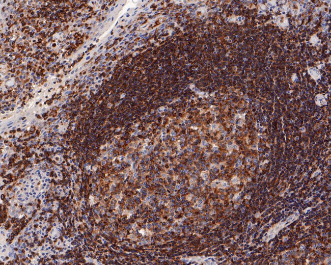 CSF1R Antibody in Immunohistochemistry (Paraffin) (IHC (P))