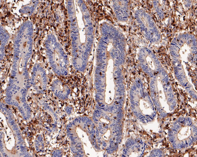 CSF1R Antibody in Immunohistochemistry (Paraffin) (IHC (P))