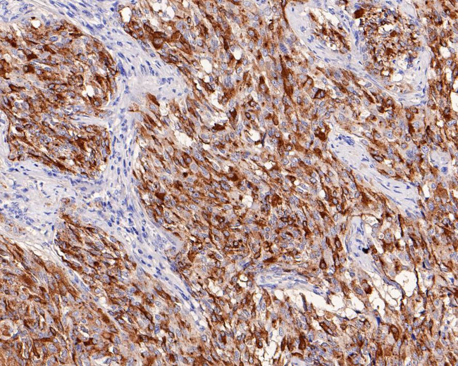 Calcitonin Antibody in Immunohistochemistry (Paraffin) (IHC (P))