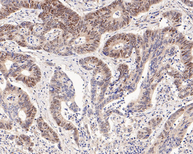 c-Myc Antibody in Immunohistochemistry (Paraffin) (IHC (P))