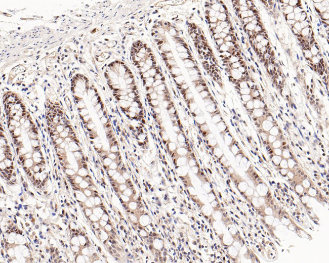 c-Myc Antibody in Immunohistochemistry (Paraffin) (IHC (P))