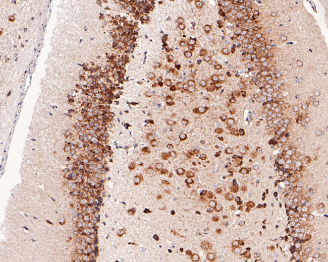 eIF4E Antibody in Immunohistochemistry (Paraffin) (IHC (P))