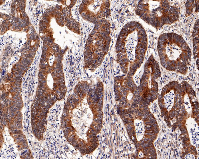 RMP Antibody in Immunohistochemistry (Paraffin) (IHC (P))