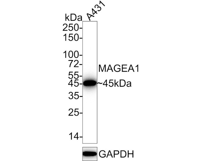 MAGE1 Antibody in Immunohistochemistry (Paraffin) (IHC (P))