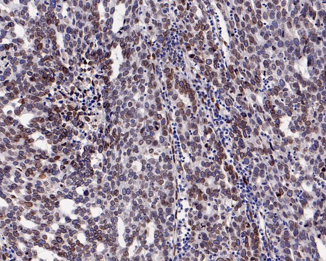 FBXW7 Antibody in Immunohistochemistry (Paraffin) (IHC (P))