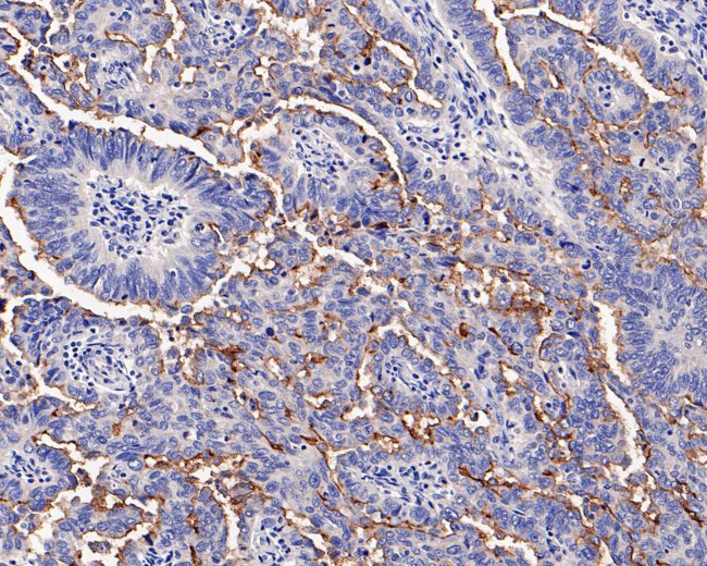 SLC34A2 Antibody in Immunohistochemistry (Paraffin) (IHC (P))