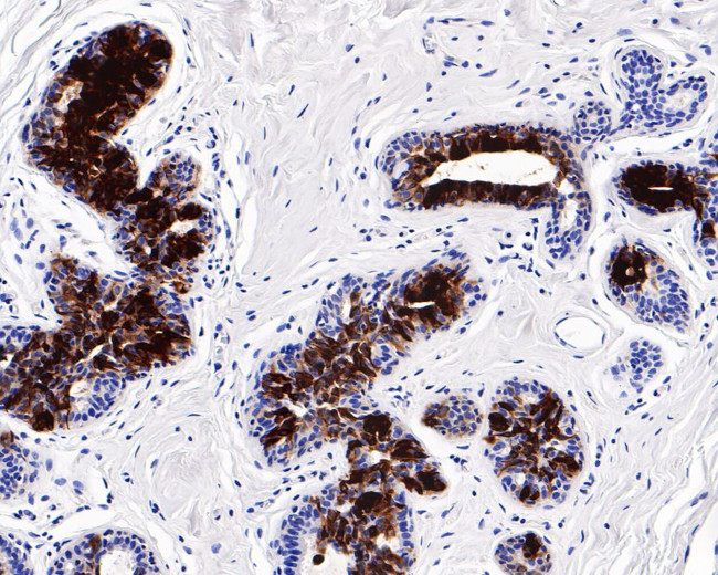 Mammaglobin A Antibody in Immunohistochemistry (Paraffin) (IHC (P))