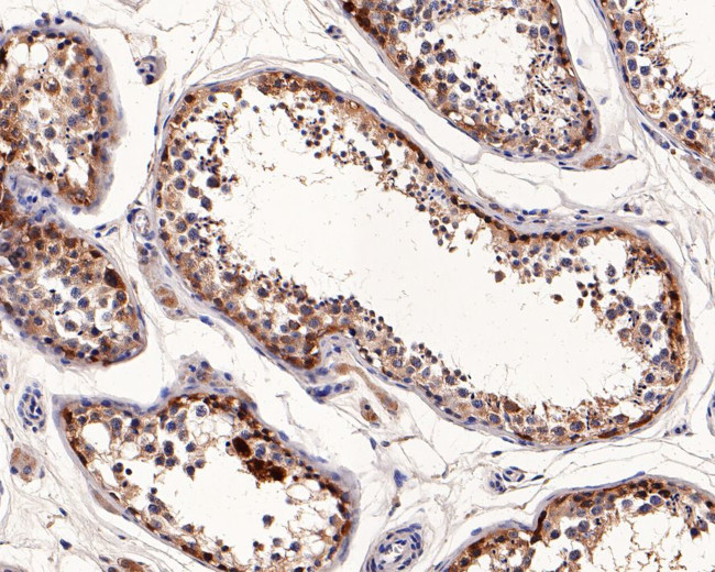 CTAG1B Antibody in Immunohistochemistry (Paraffin) (IHC (P))