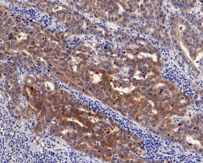 CTAG1B Antibody in Immunohistochemistry (Paraffin) (IHC (P))