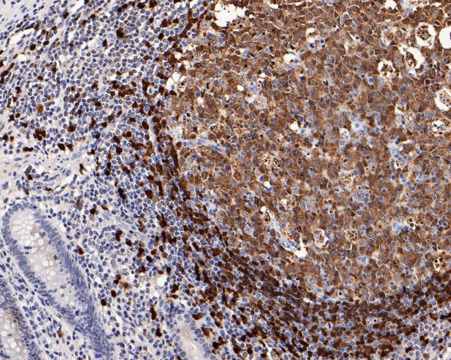 TCL1A Antibody in Immunohistochemistry (Paraffin) (IHC (P))