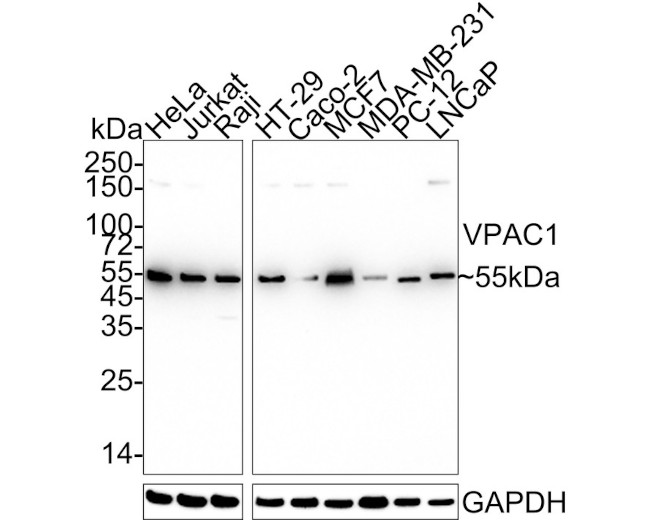 VIPR1 Antibody in Immunohistochemistry (Paraffin) (IHC (P))