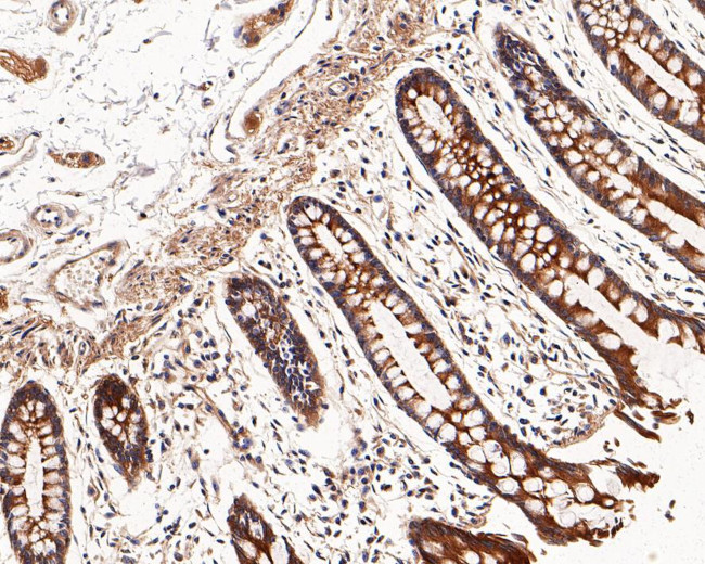 RALA Antibody in Immunohistochemistry (Paraffin) (IHC (P))