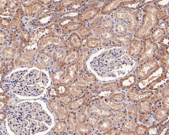 RALA Antibody in Immunohistochemistry (Paraffin) (IHC (P))