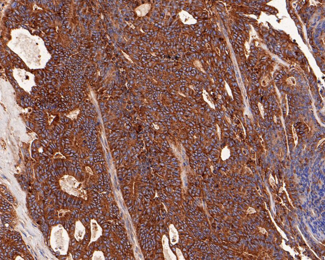 RALA Antibody in Immunohistochemistry (Paraffin) (IHC (P))