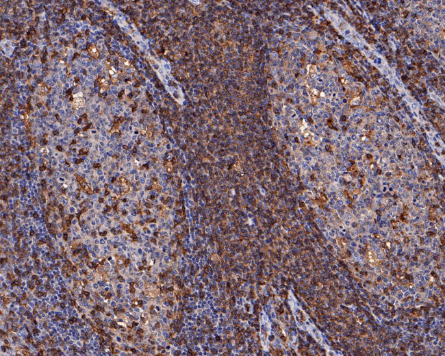 CD43 Antibody in Immunohistochemistry (Paraffin) (IHC (P))