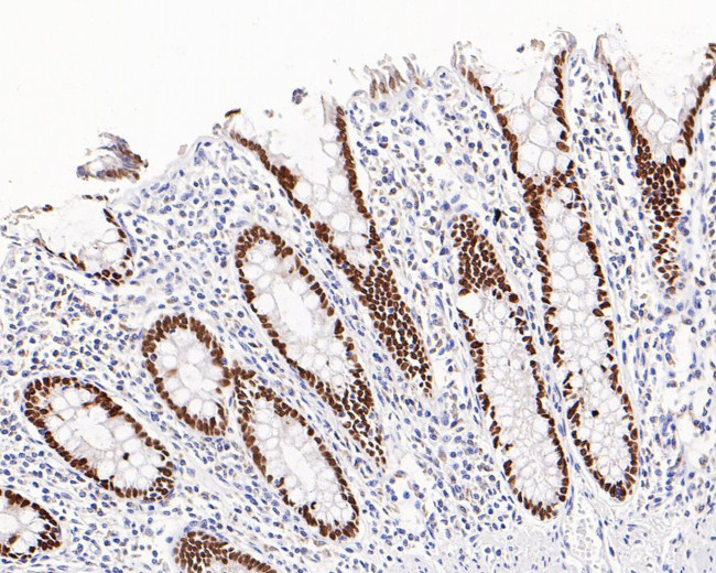 SATB2 Antibody in Immunohistochemistry (Paraffin) (IHC (P))