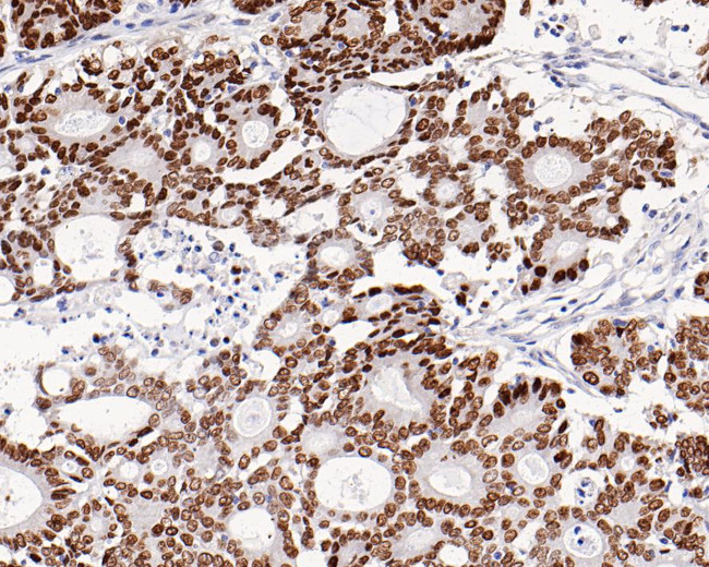 SATB2 Antibody in Immunohistochemistry (Paraffin) (IHC (P))