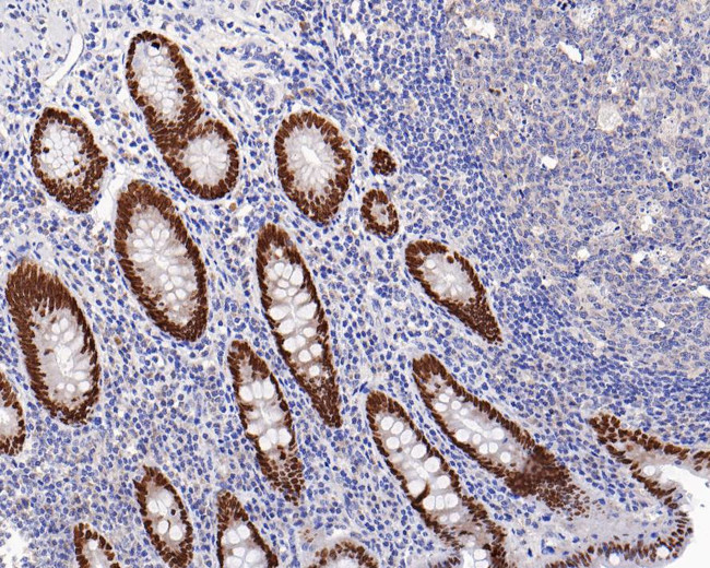 SATB2 Antibody in Immunohistochemistry (Paraffin) (IHC (P))