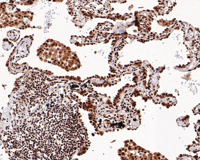 SETD1A Antibody in Immunohistochemistry (Paraffin) (IHC (P))