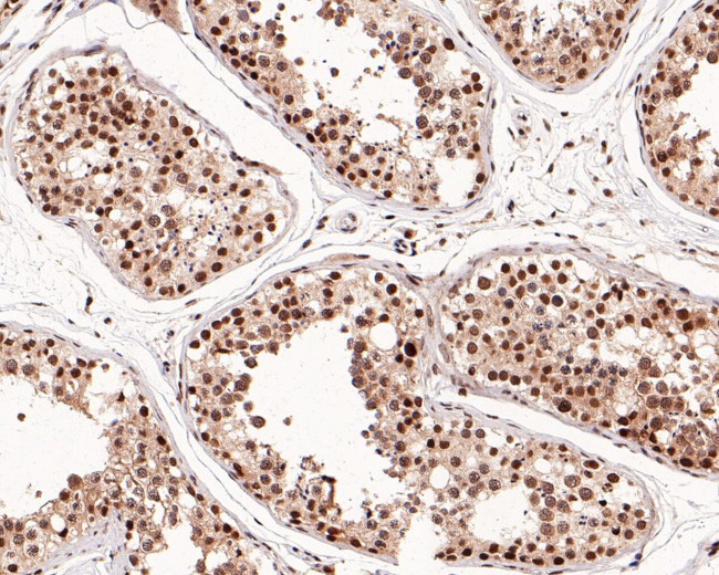 SETD1A Antibody in Immunohistochemistry (Paraffin) (IHC (P))