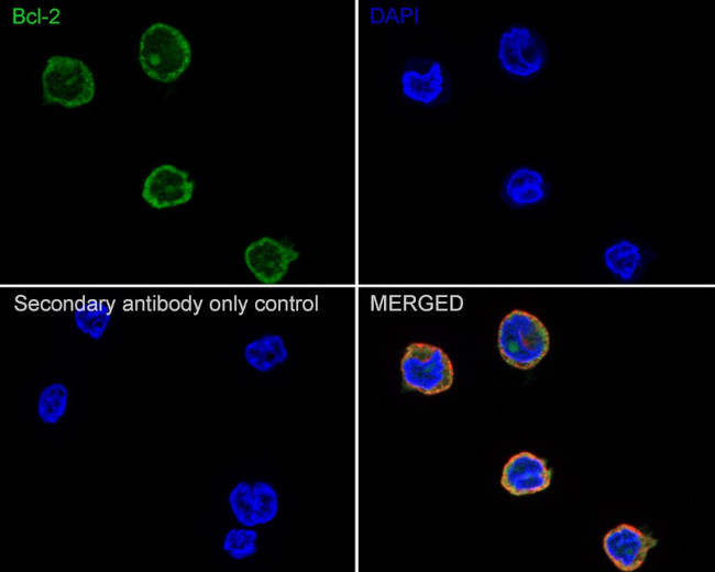 Bcl-2 Antibody in Immunocytochemistry (ICC/IF)