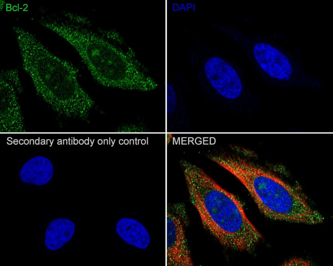 Bcl-2 Antibody in Immunocytochemistry (ICC/IF)