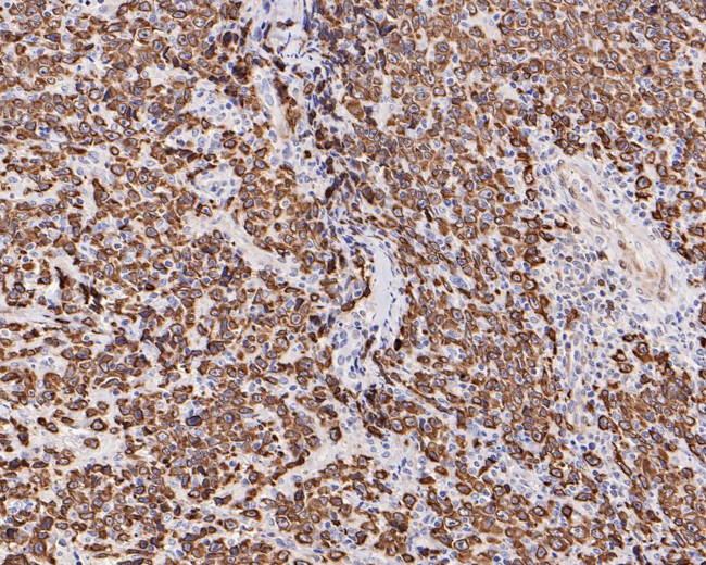 Bcl-2 Antibody in Immunohistochemistry (Paraffin) (IHC (P))