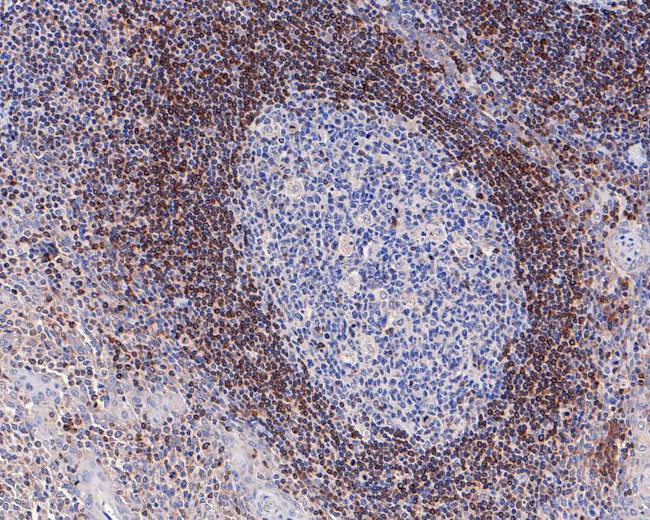 Bcl-2 Antibody in Immunohistochemistry (Paraffin) (IHC (P))