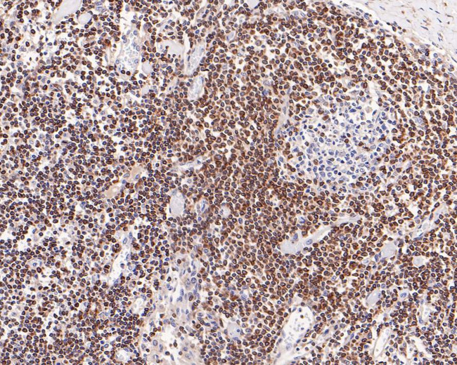 Bcl-2 Antibody in Immunohistochemistry (Paraffin) (IHC (P))