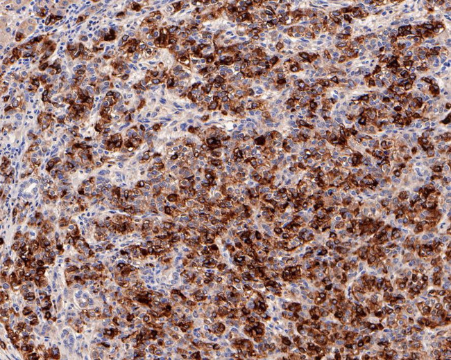 AFP Antibody in Immunohistochemistry (Paraffin) (IHC (P))